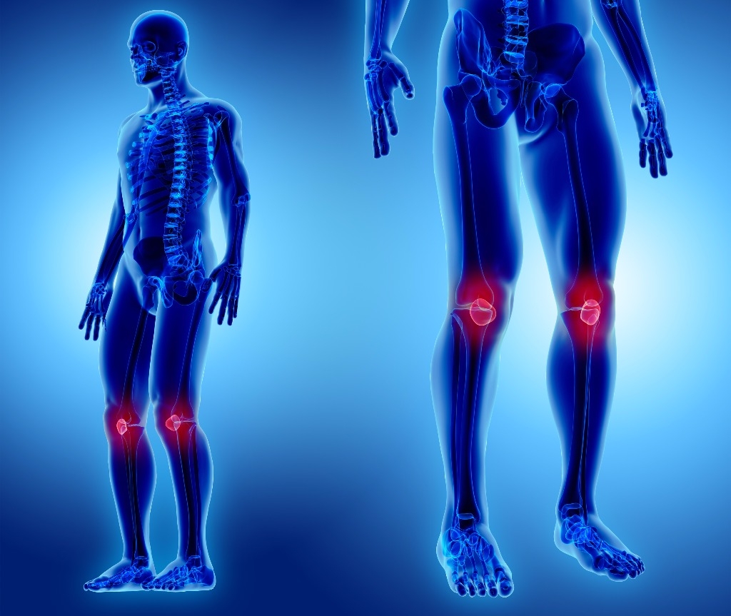 osteoartrit ve yüksek tansiyon yüksek tansiyon için arı ekmeği nasıl alınır